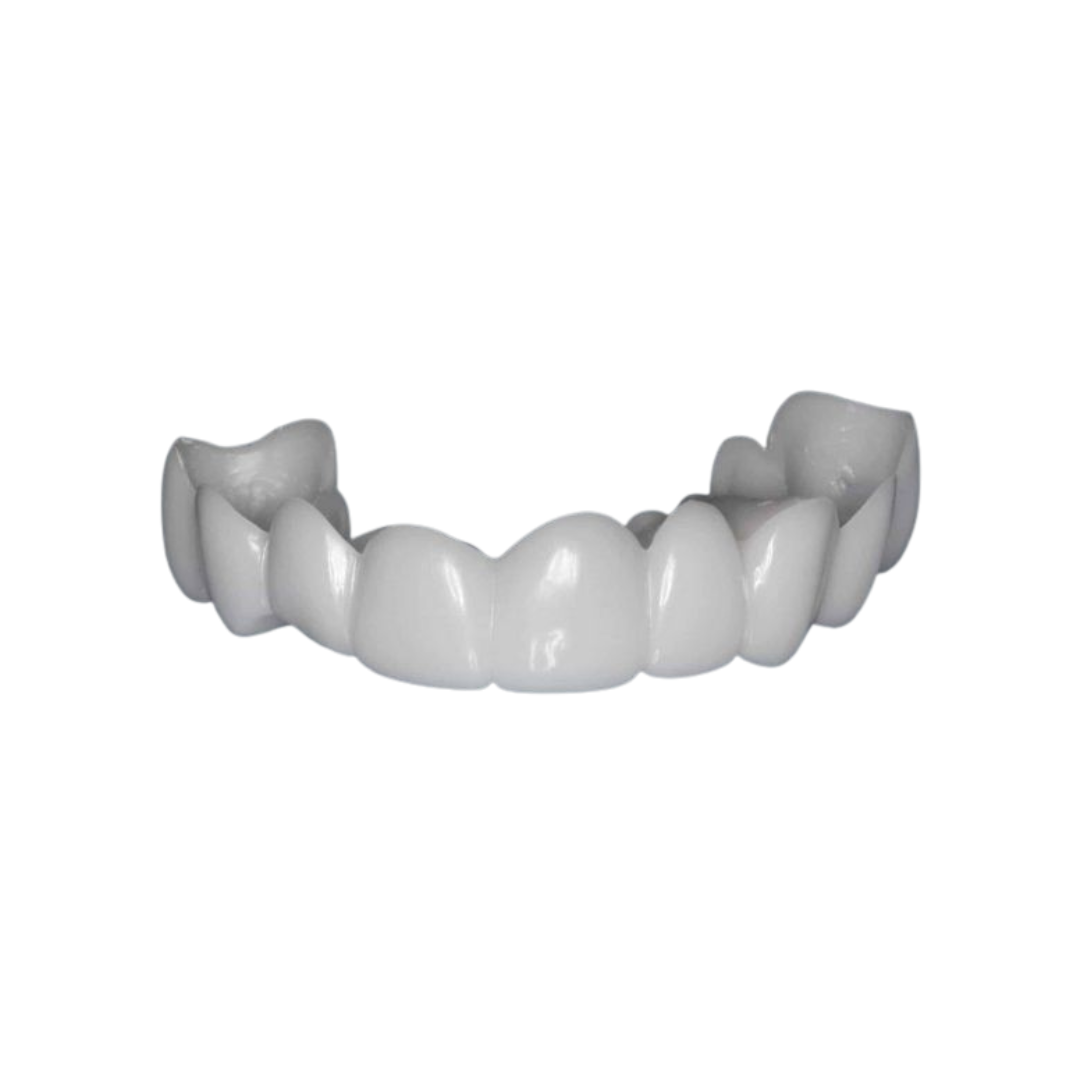SmileLuxe™ Snap-On Veneers