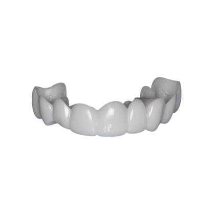 SmileLuxe™ Snap-On Veneers