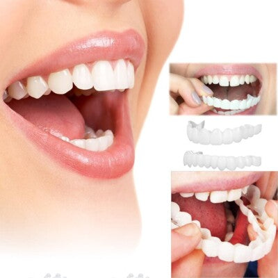 SmileLuxe™ Snap-On Veneers